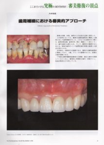 下関市のおおむら歯科医院にて歯周病治療を行なった症例が掲載された専門誌
